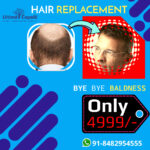 best hair replacement center in pune