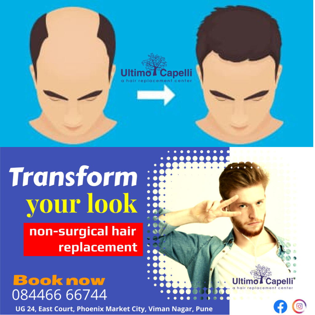 Hair Replacement Center in Pune – UltimoCapelliHair