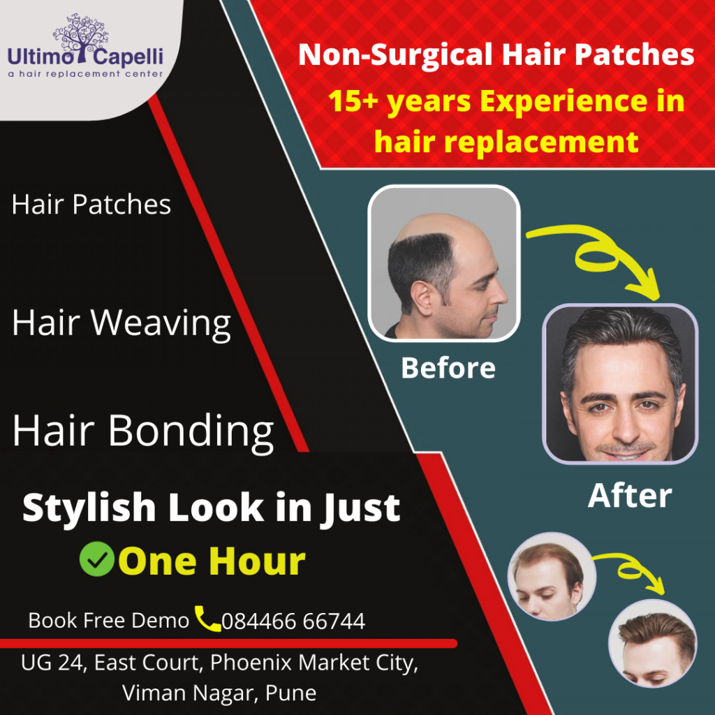 Hair Replacement Center in Pune – UltimoCapelliHair